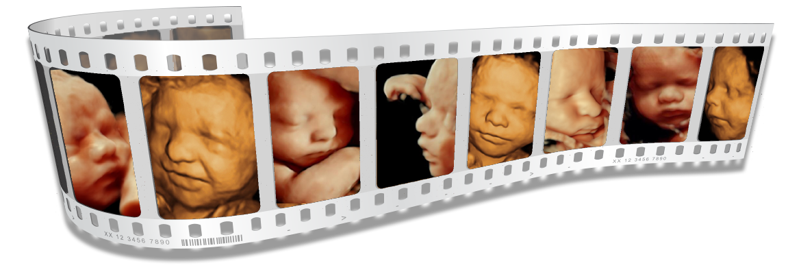 HD Ultrasound