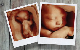 hd ultrasound